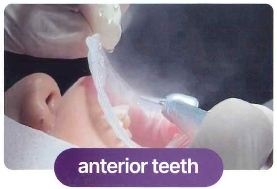 ヒッポ U イメージ画像