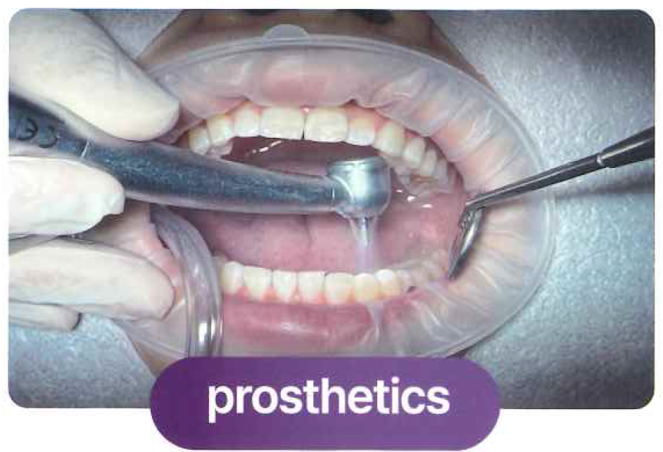 ヒッポ U イメージ画像