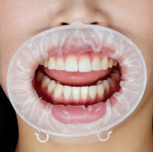 ヒッポ U イメージ画像